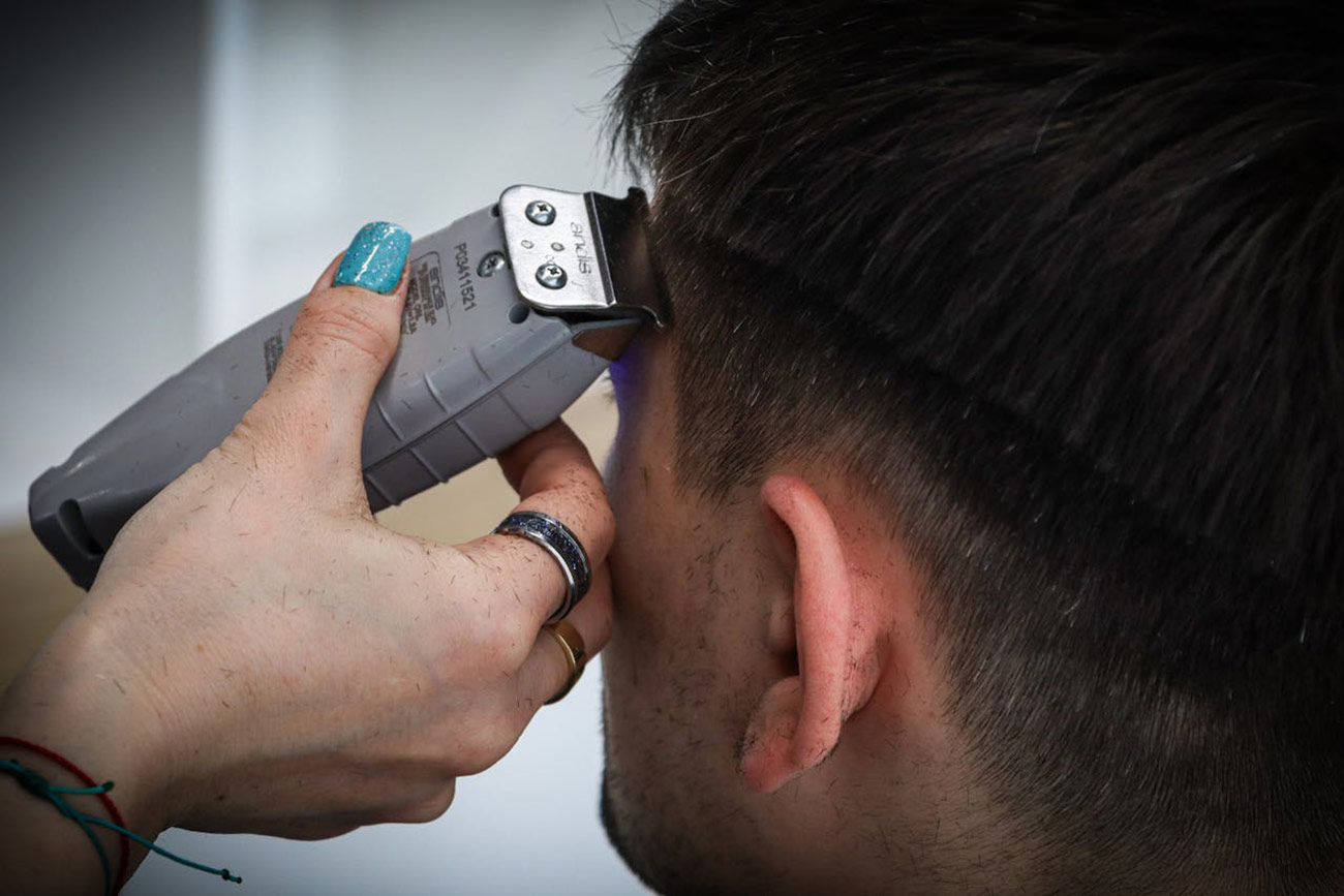 Innovaciones en prótesis capilares 2025: materiales, diseño y tendencias